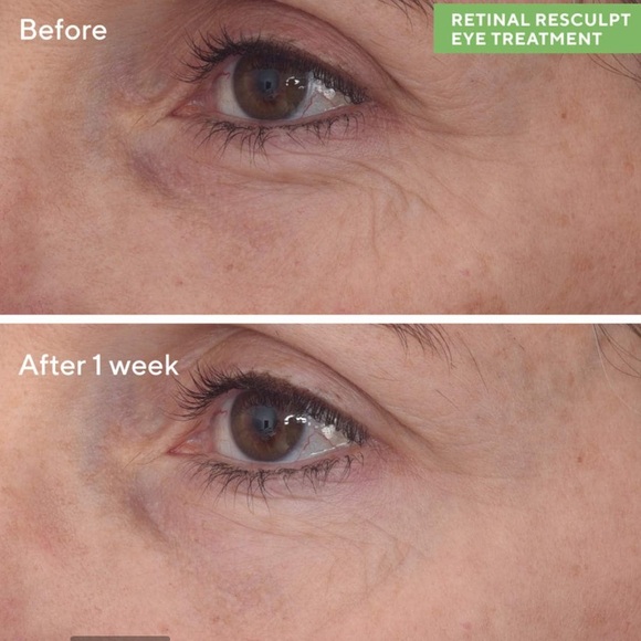 Pick 8/$50 Murad Retinal ReSculpt Eye Treatment🆕deluxe sample size - Picture 5 of 10